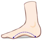 ハイアーチのアーチ構造イラスト