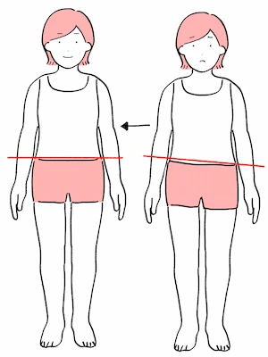 骨盤の高さが違う女性