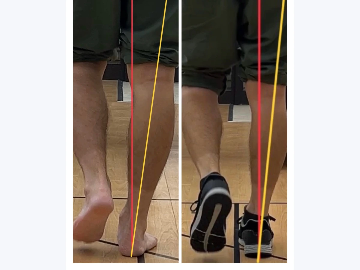 歩行比較の写真