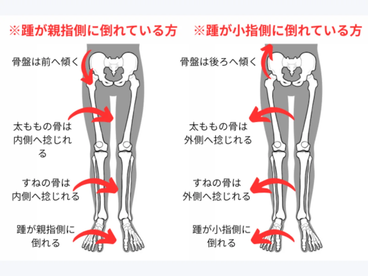 運動連鎖のイラスト
