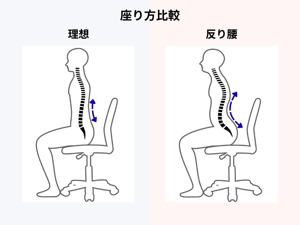 反り腰比較イラスト