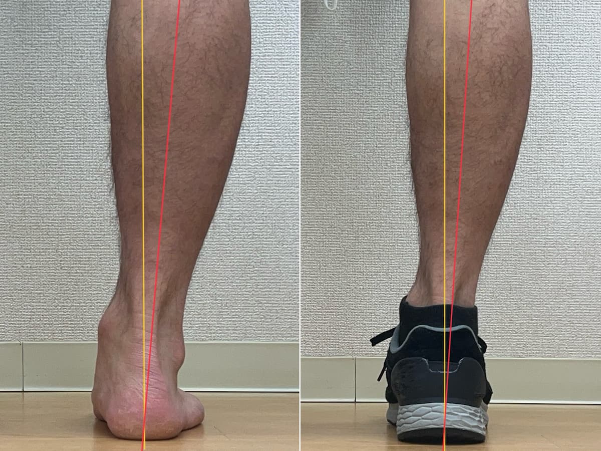 足の倒れこみ比較