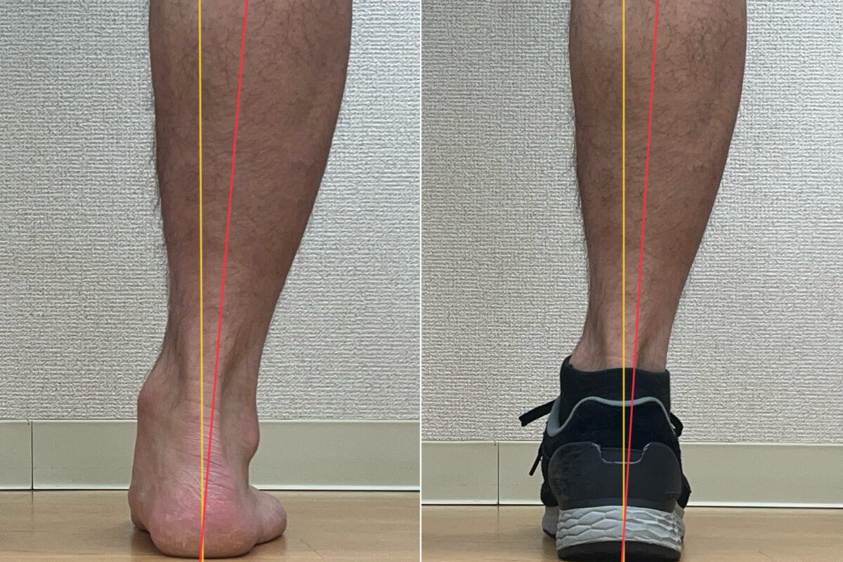 足比較写真