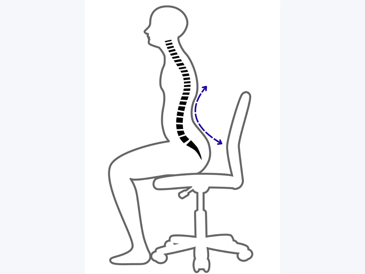 骨盤前傾反り腰イラスト