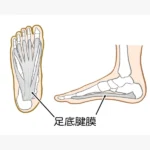 足底腱膜の位置