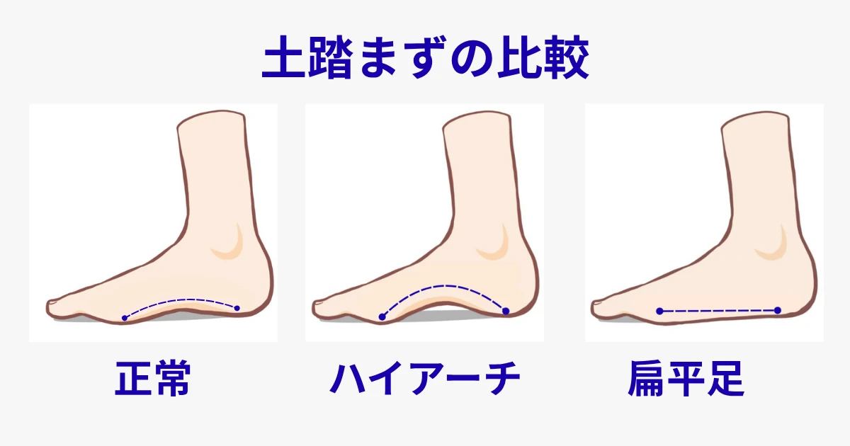 アーチ比較イラスト