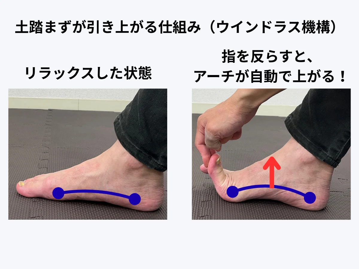 ウインドラス機構の写真
