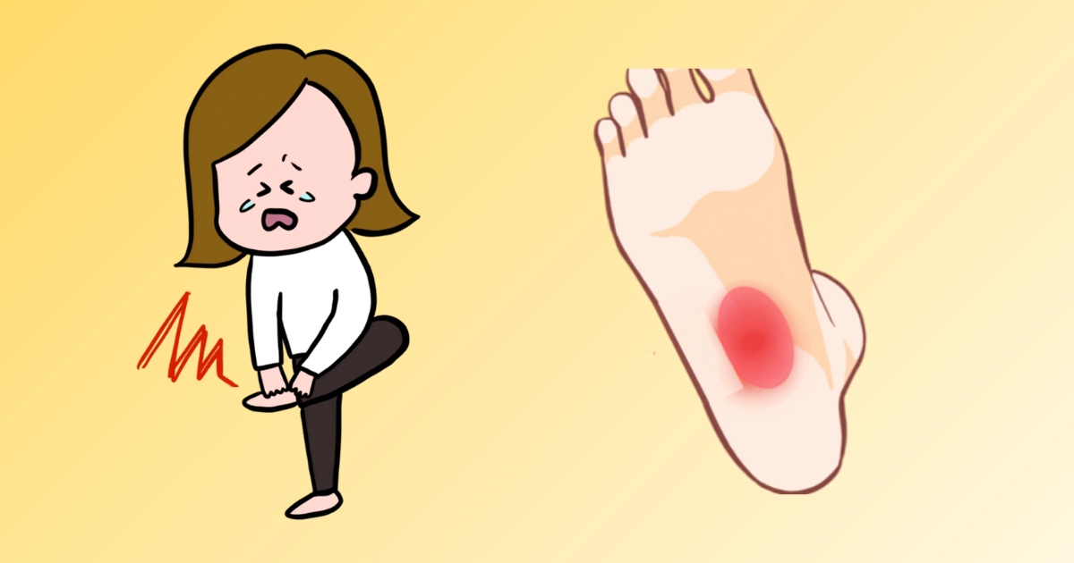 足の裏が痛い女性と痛みが出ている場所のイラスト